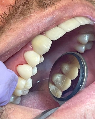 Photo post from trilliumdental.
