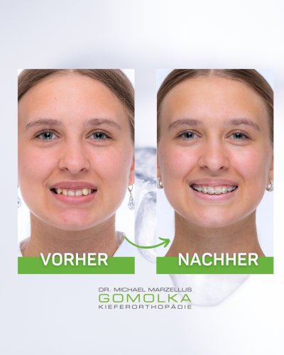 Photo post from dr.gomolka.