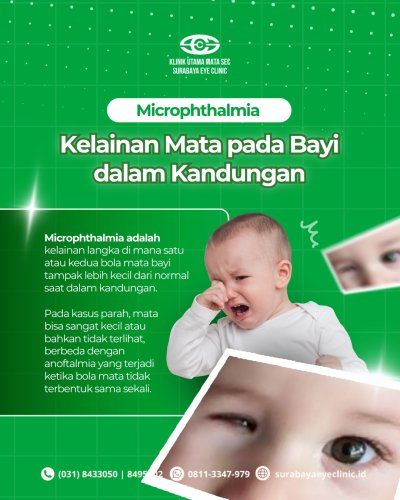 PostPhoto