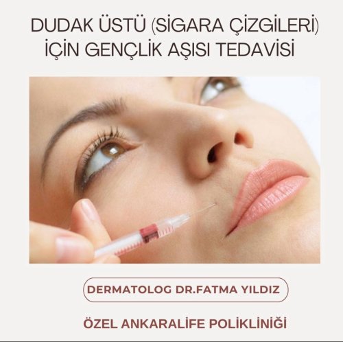 PostPhoto