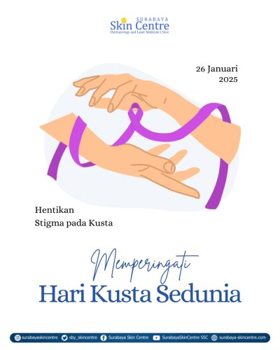 PostPhoto