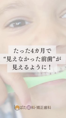Video post.