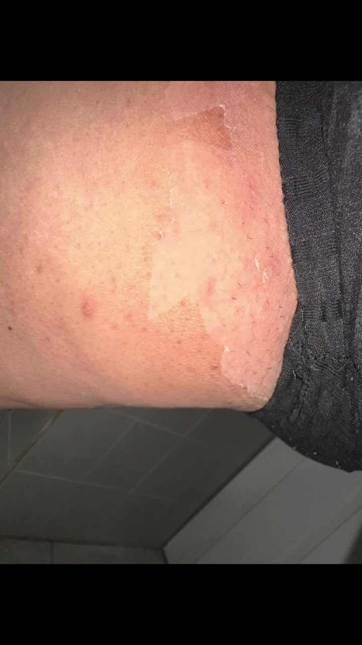 Video post from richbichclinic.