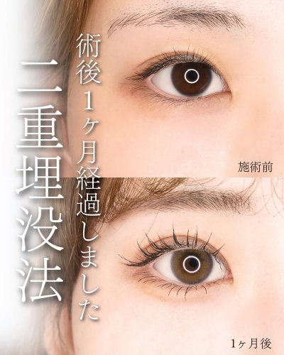 Carousel post from tcb.kawashima.