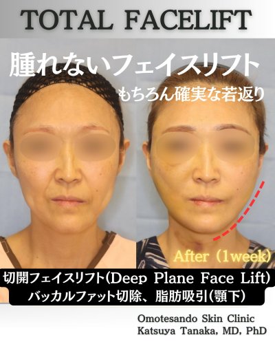 田中 克弥 医師 | 美容外科・美容皮膚科なら表参道スキンクリニック