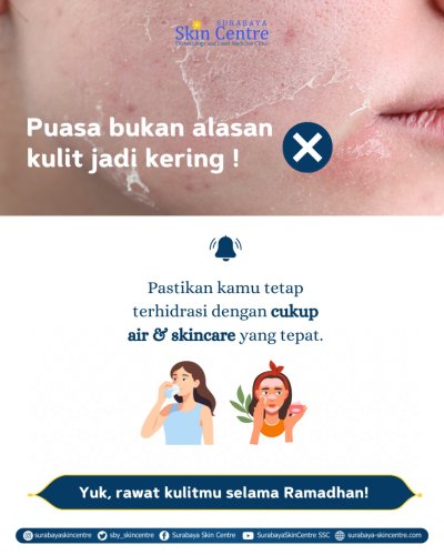 PostPhoto