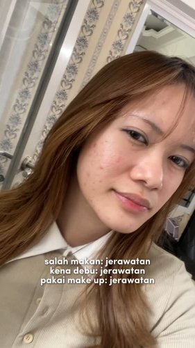 PostPhoto