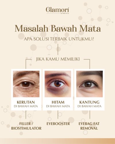 PostPhoto