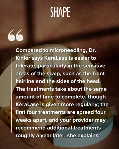 Photo post from kerafactor.