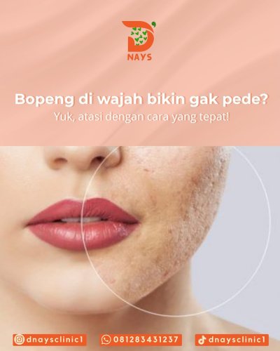 PostPhoto