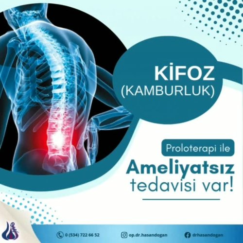 Video post from op.dr.hasandogan.