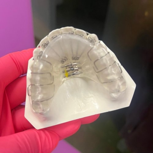 Photo post from trilliumdental.