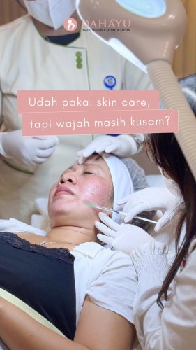 PostPhoto