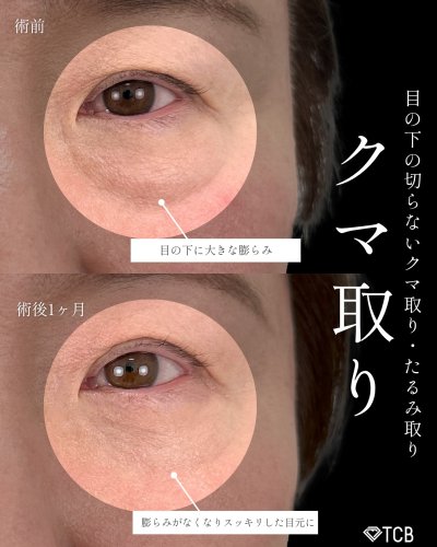 Carousel post from tcb_hashimoto.