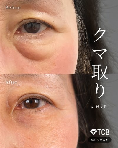 Carousel post from tcb_watanabe_masashi.