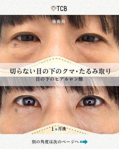 Carousel post from tcb_ishihara.tsubasa.