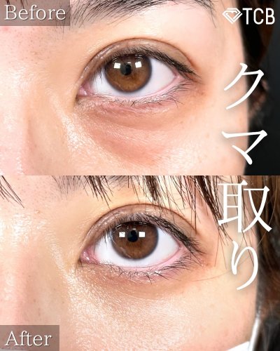 Carousel post from tcb_iwamoto.