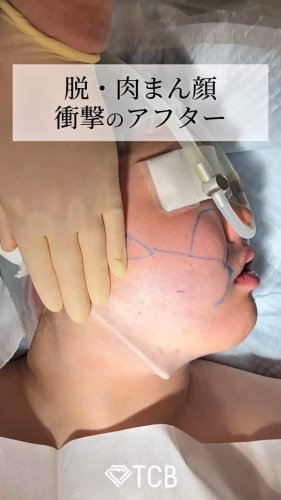 Video post from tcb_omi.
