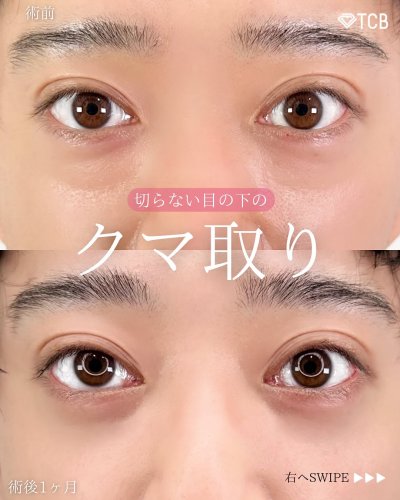 Carousel post from tcb_sayo_terao.