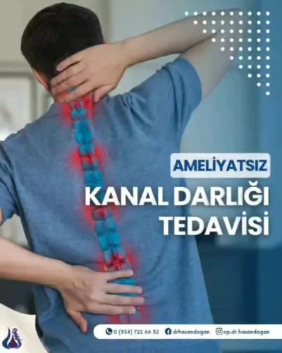 Video post from op.dr.hasandogan.