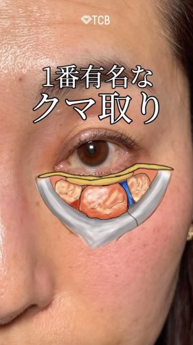 Video post from tcb_kurashima.