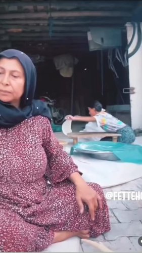 Video post from op.dr.hasandogan.