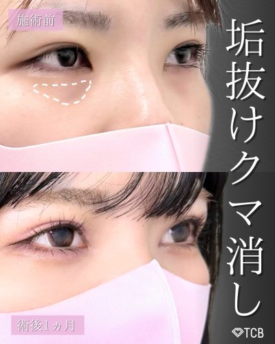 Carousel post from tcb_kuribayashi.