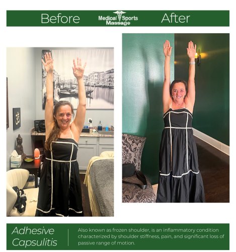 Photo post from medicalsportsmassage.