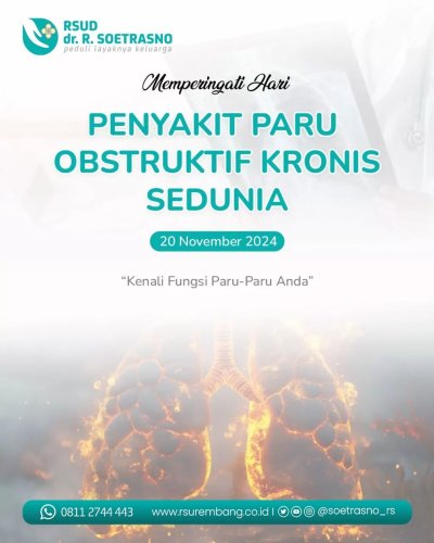 Photo post from soetrasno_rs.