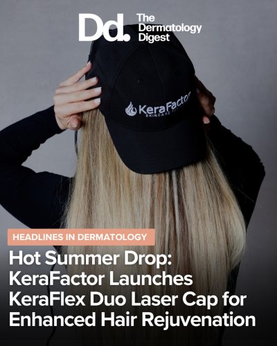 Photo post from kerafactor.