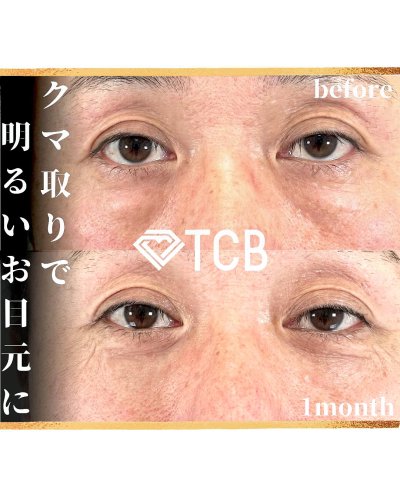 Carousel post from tcb_yamaguchi.s.