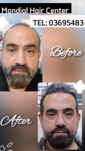 Video post from mondialhaircenter.