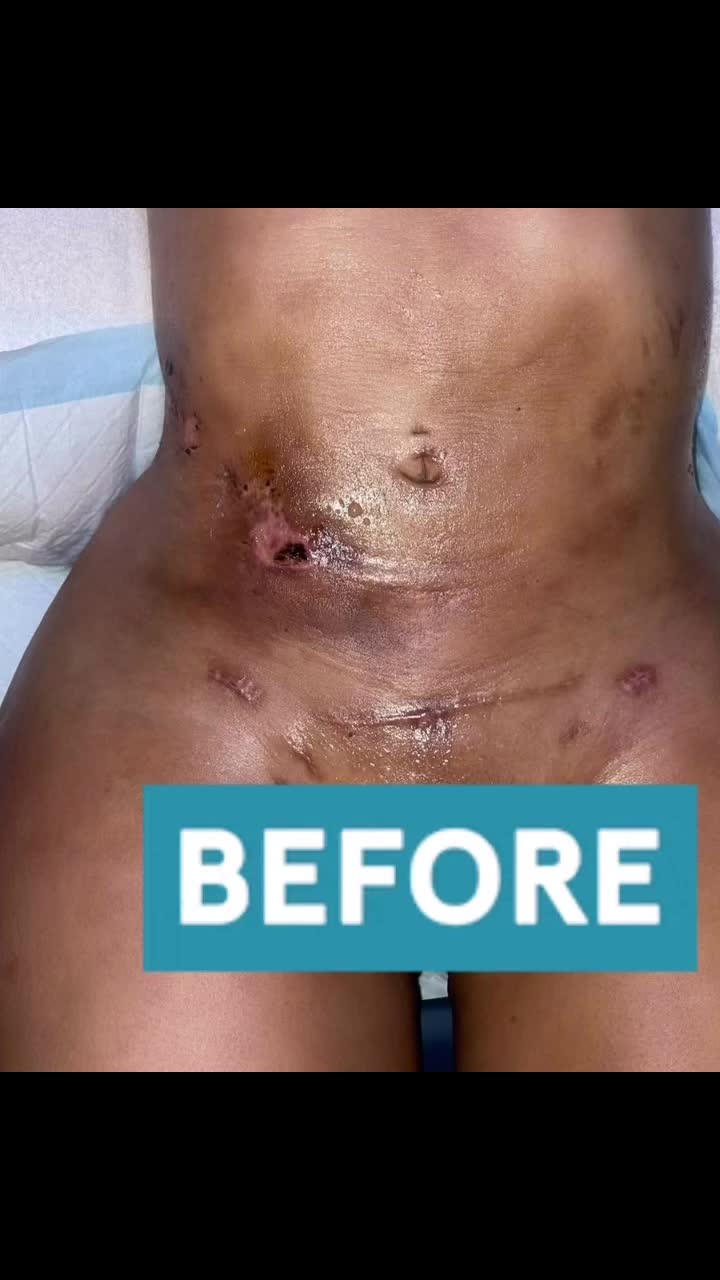 Video post from richbichclinic.