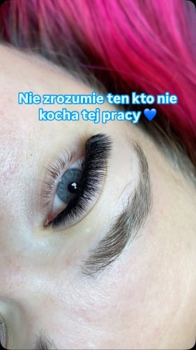 PostPhoto