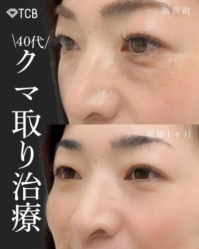 Carousel post from tcb_sakamoto.