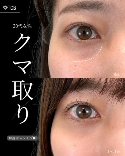 Carousel post from tcb_tomita_ryo.