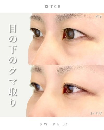 Carousel post from tcb_kamiyama.
