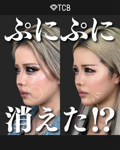 Carousel post from tcb_yamamoto.