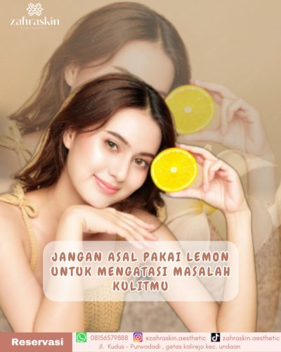 PostPhoto