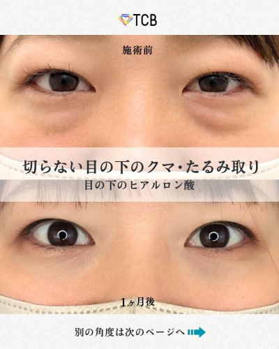 Carousel post from tcb_ishihara.tsubasa.