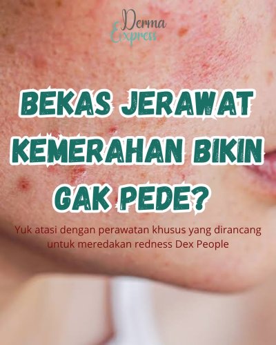 PostPhoto