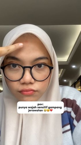 PostPhoto