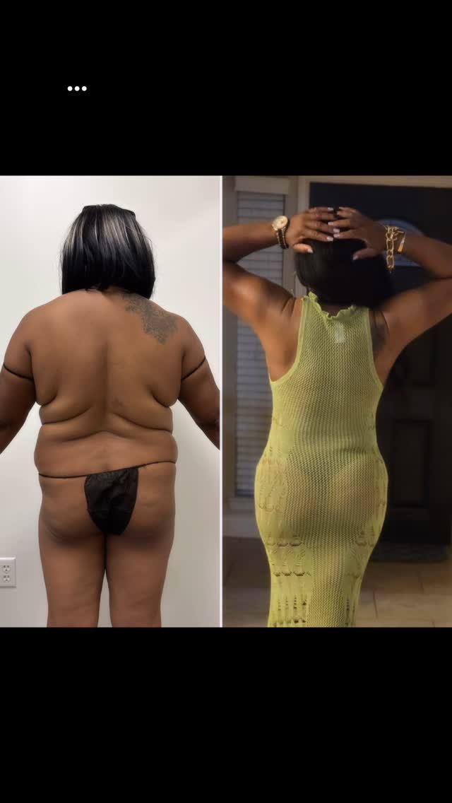 Medical Weight Loss with GLP-1 in Houston & Sugar Land Medical Weight Loss with GLP-1 in Houston & Sugar Land