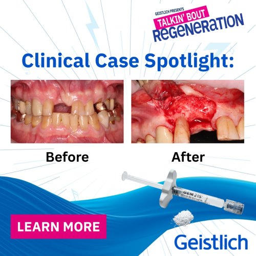 Photo post from geistlich_north_america.