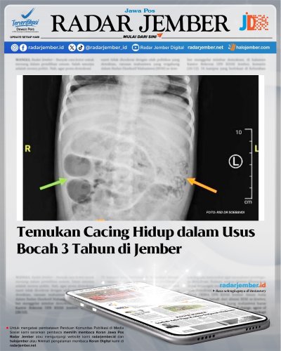 PostPhoto