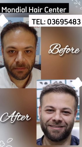 Video post from mondialhaircenter.