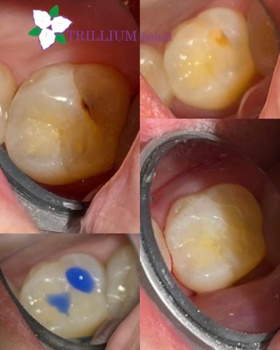 Photo post from trilliumdental.