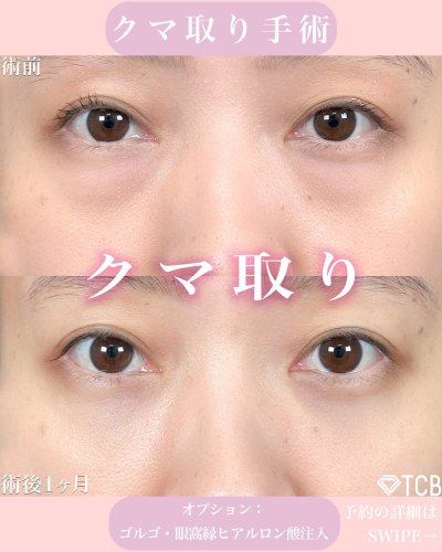 Carousel post from tcb_muraoka_futae.