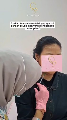 PostPhoto