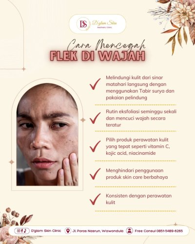 PostPhoto